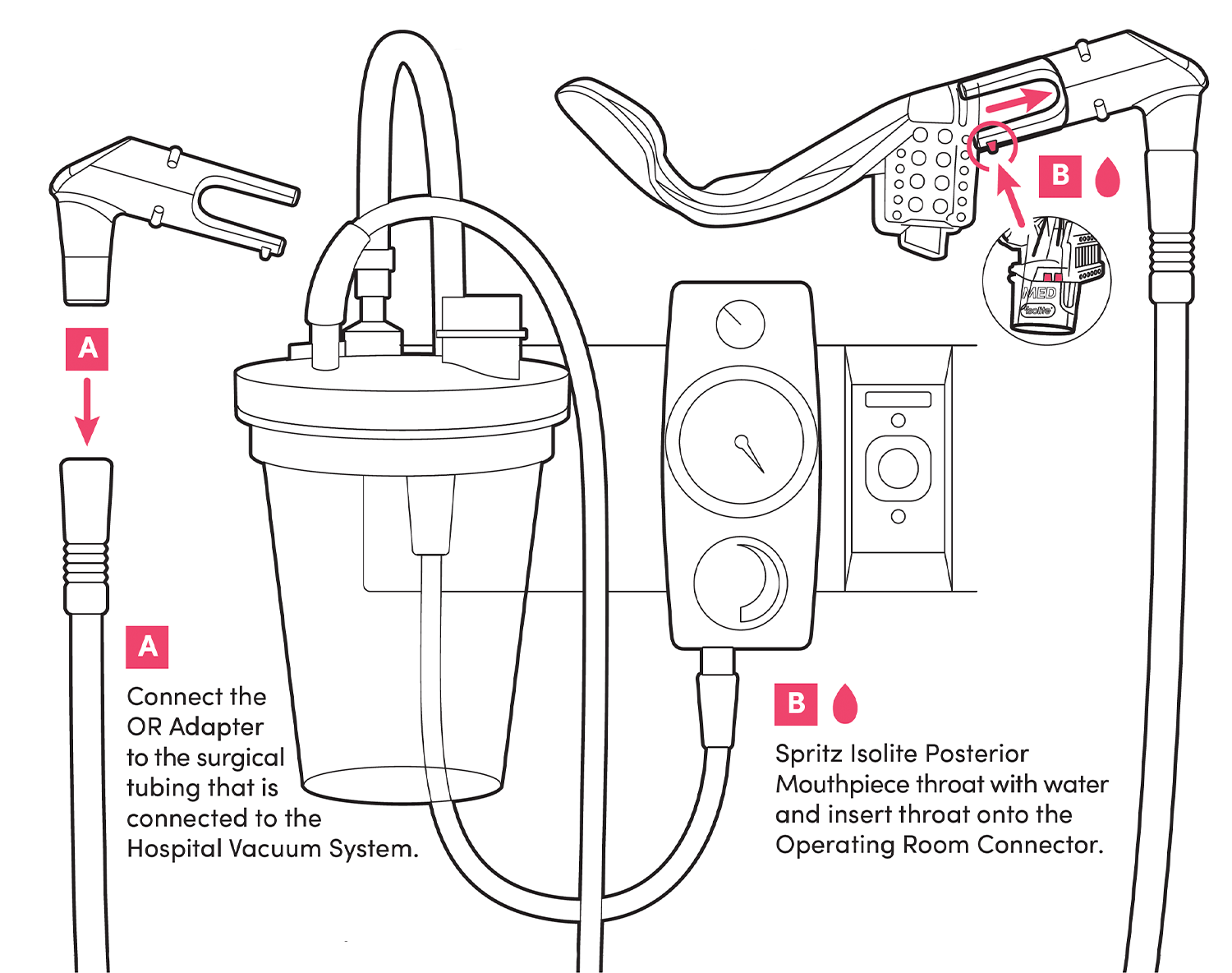 The Isolite Operating Room Adapter connects effortlessly to standard operating room suction systems.